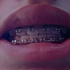 bracesfetish (Braces fetish) free OnlyFans Leaks 

 profile picture