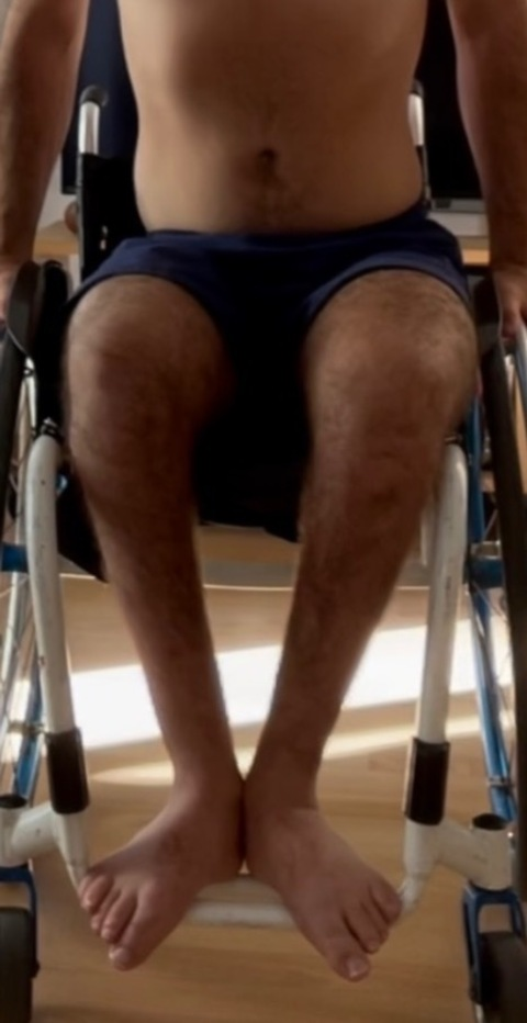 paraplegicboy onlyfans leaked picture 2